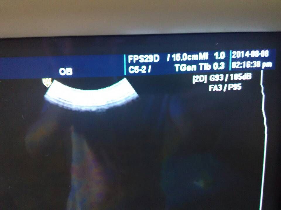 PHILIPS C5-2 abdominal probe for HDI5000